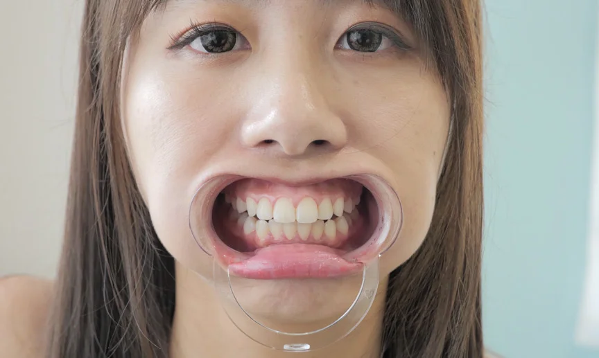愛里るいちゃんの歯・のどちんこ・舌ベロフェチ！-5