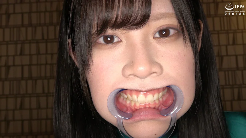 エマちゃんの歯・口内・舌ベロを観察してみた-1