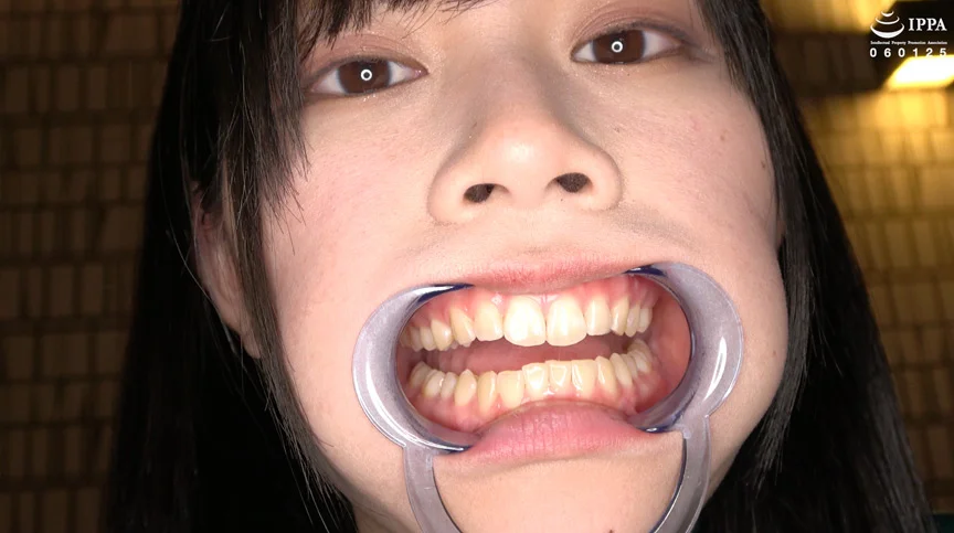 エマちゃんの歯・口内・舌ベロを観察してみた-7