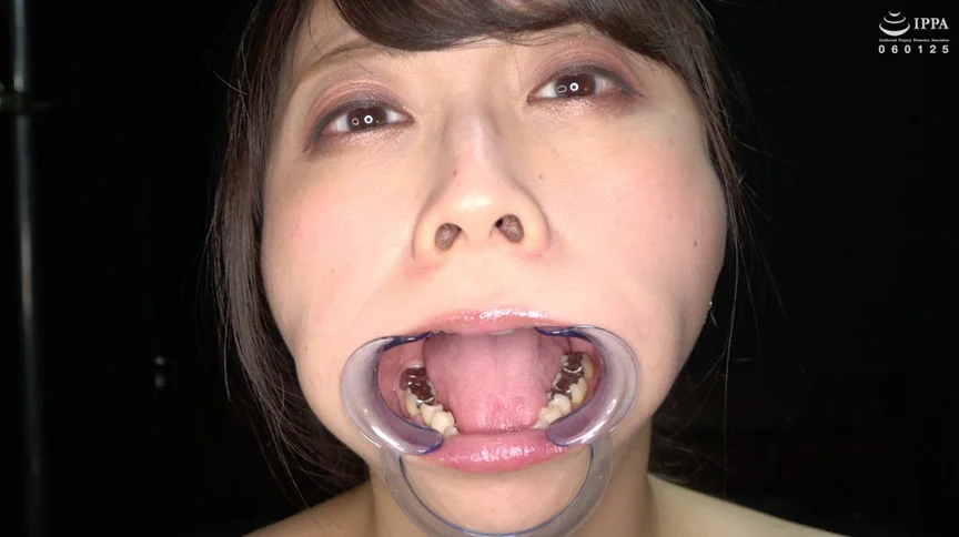 優木なおチャンの銀歯だらけの激レア歯・口内観察！！！-2