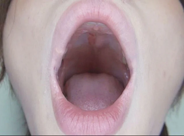 100人のおくち 第9集-10