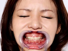 歯12
