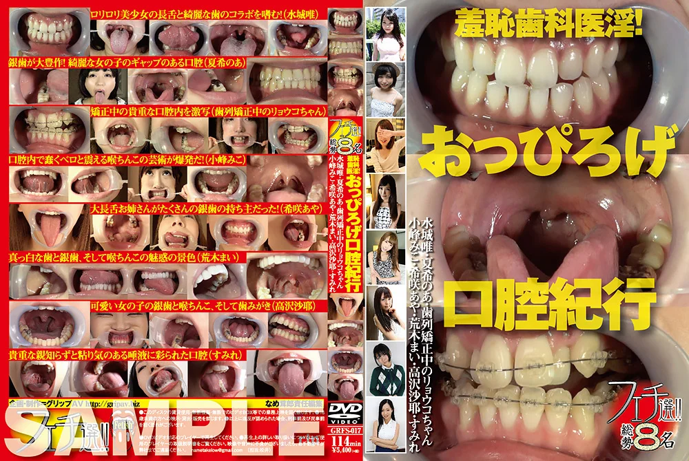 フェチ選！！羞恥歯科医淫！おっぴろげ口腔紀行