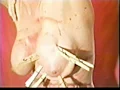 欧州カルト○問 切り裂き戦○ 後編-17