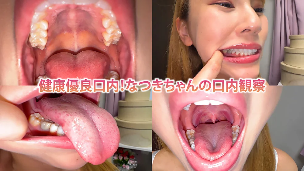 健康優良口内！なつきちゃんの日内観察