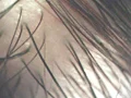 ミクロヌード 3 “超接写” 女体分解-5