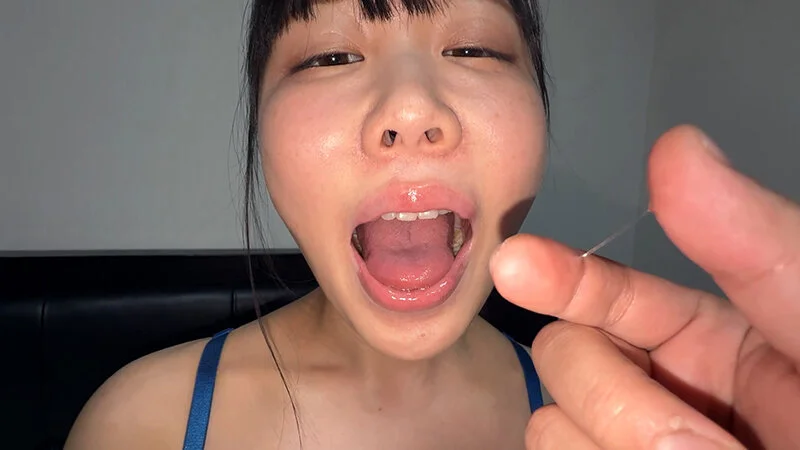 よだれダラダラすずちゃんの口内観察-4