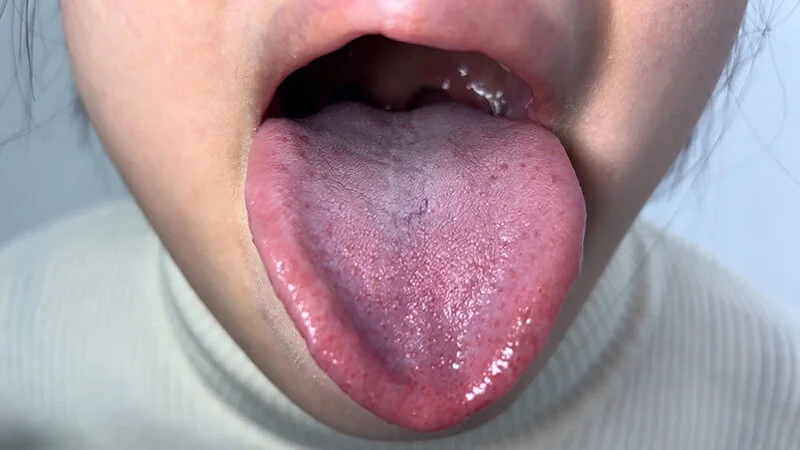 唾液たっぷりかりなちゃんの口内観察-8