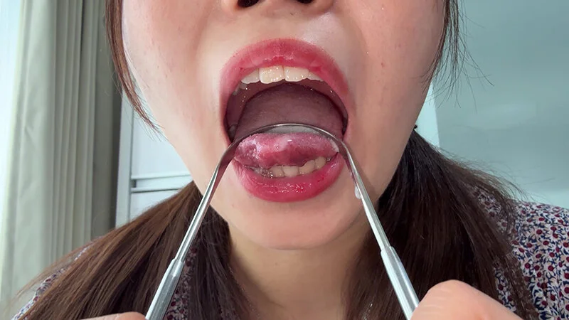 【個人撮影】水月みおの舌ブラシで「汚舌苔」採取-15