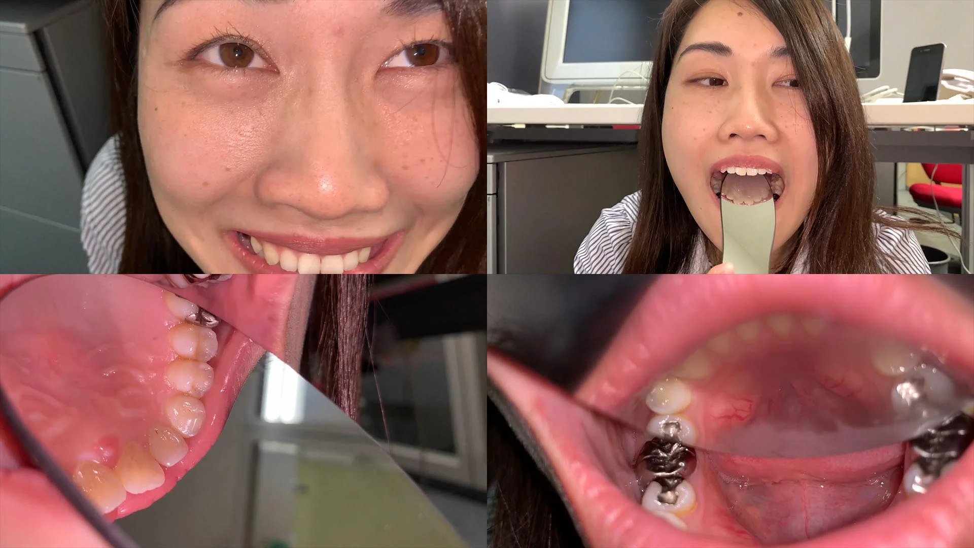 歯姫 60人目 [FBOM-00139]
