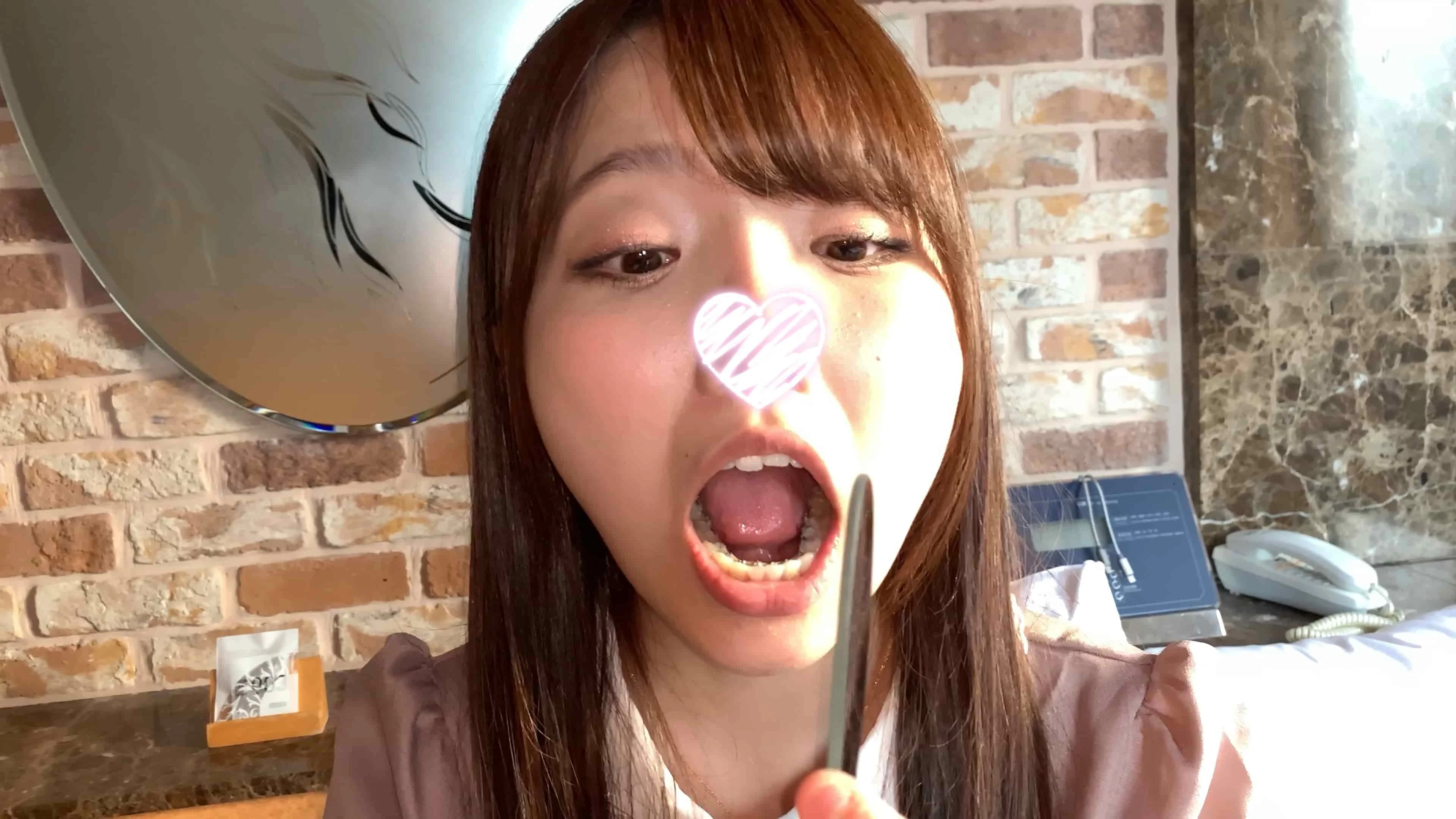 【個人撮影】激カワ美少女音大生の口内に鏡ぶち込んだら矯正器具が禍々しかったｗ　ゆい【Y-064】-3