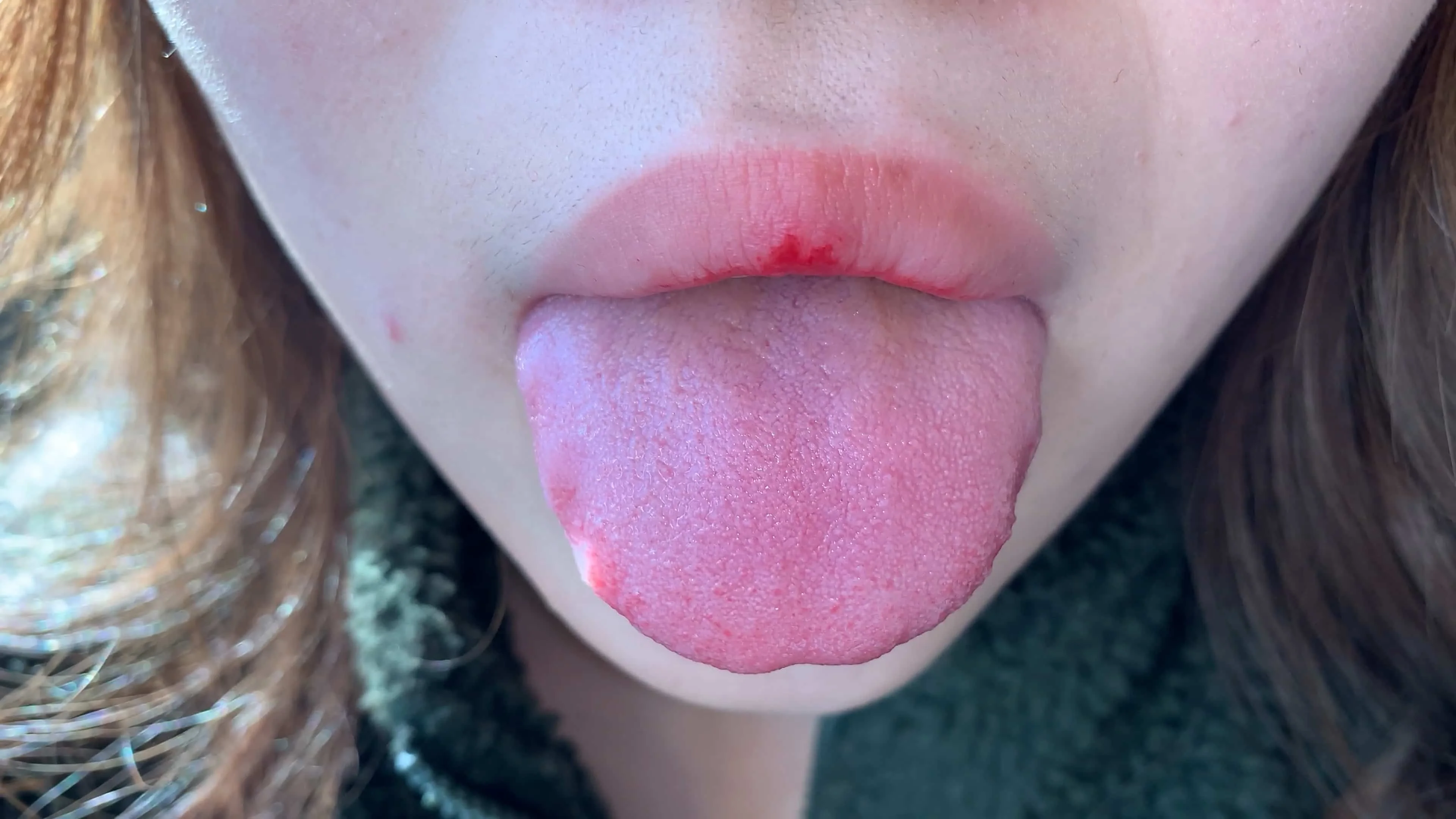 【個人撮影】（※注）巨根女（喉ちんこ）の口内を観察してみたら虫歯・ヤニ・巨大喉ちんこと逸材だった！　あんり【Y-077】-4